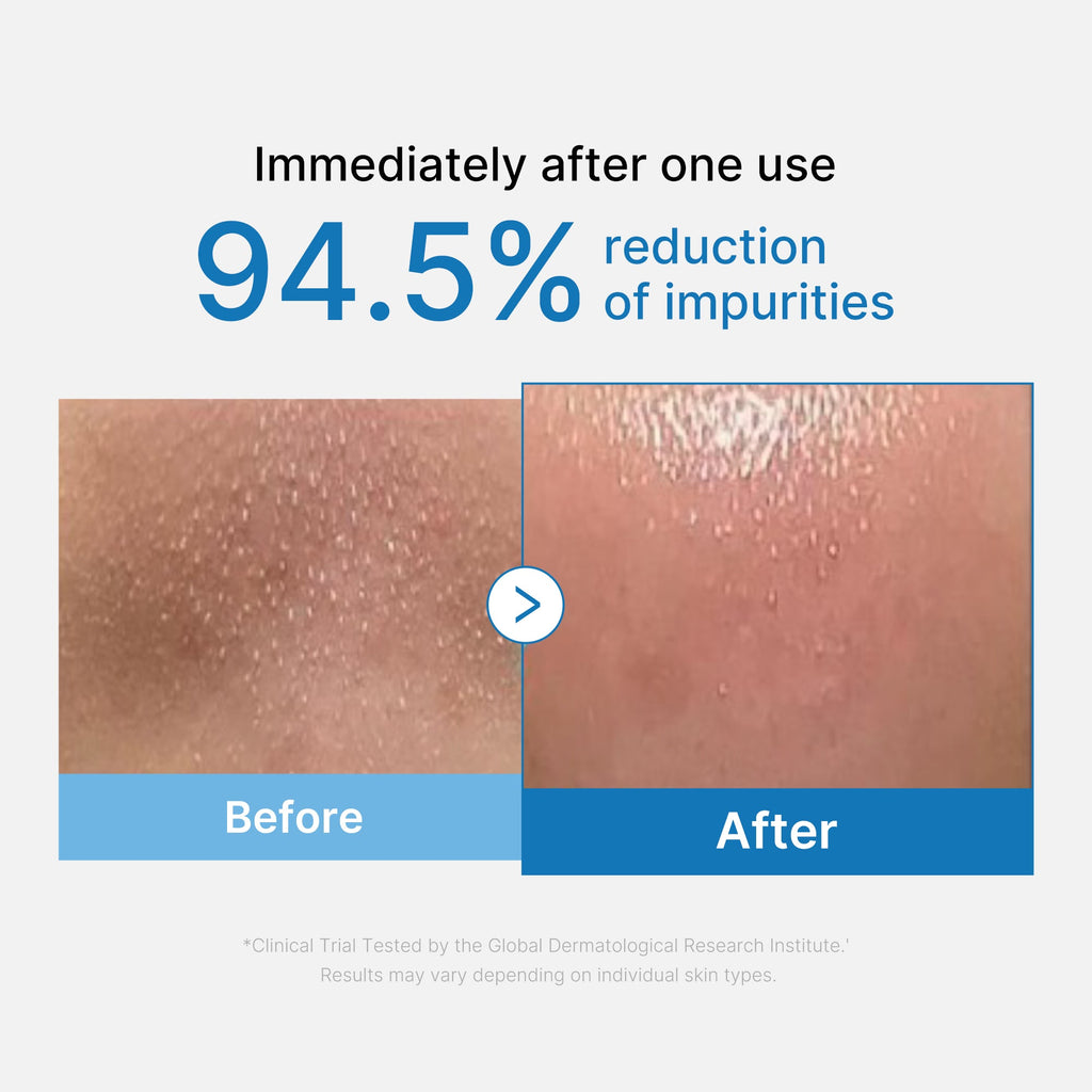 [GIFT] Zero Pore Blackhead Deep Cleansing Oil - Beautiful Medicube Care