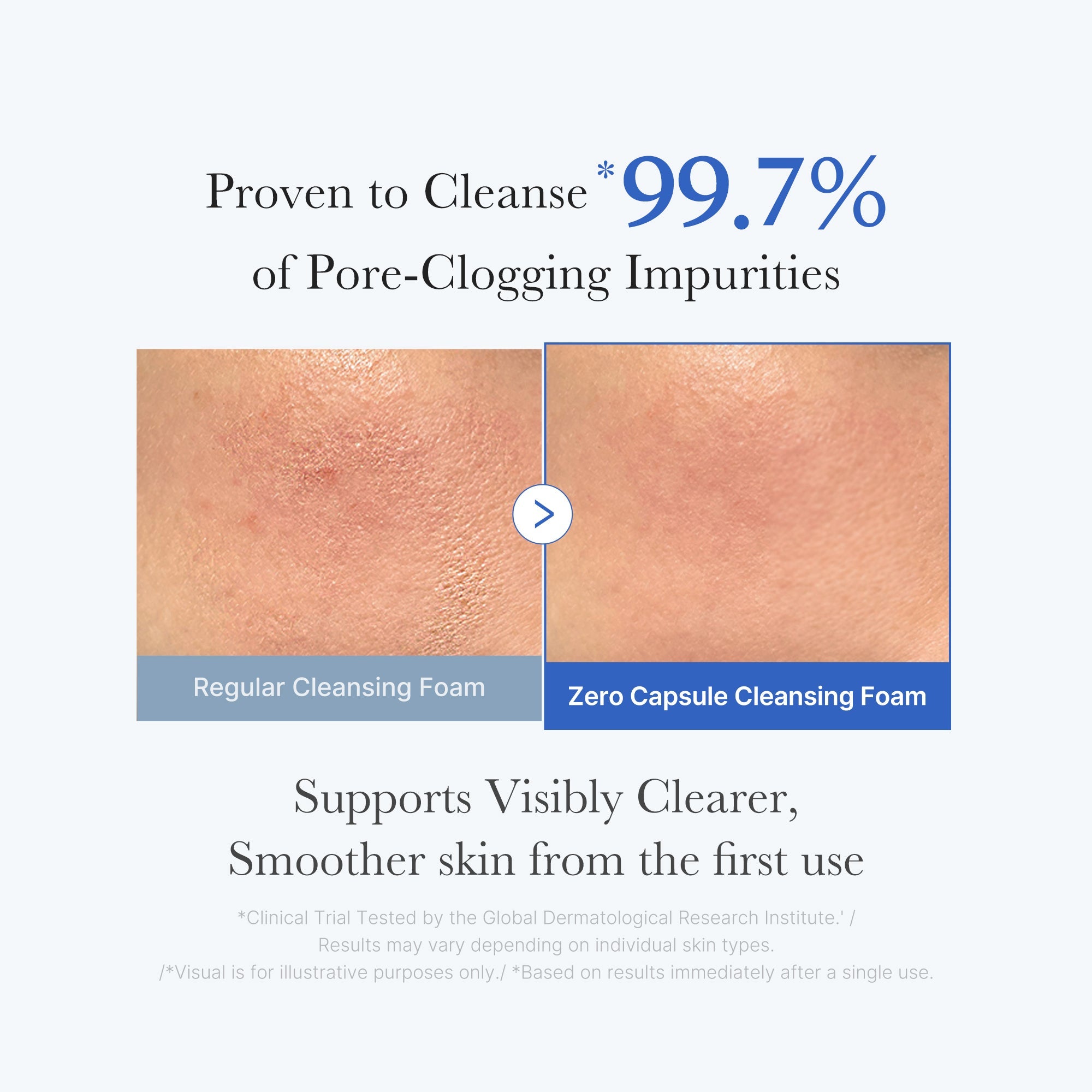Zero Pore Capsule Cleansing Foam - K Beauty with Style