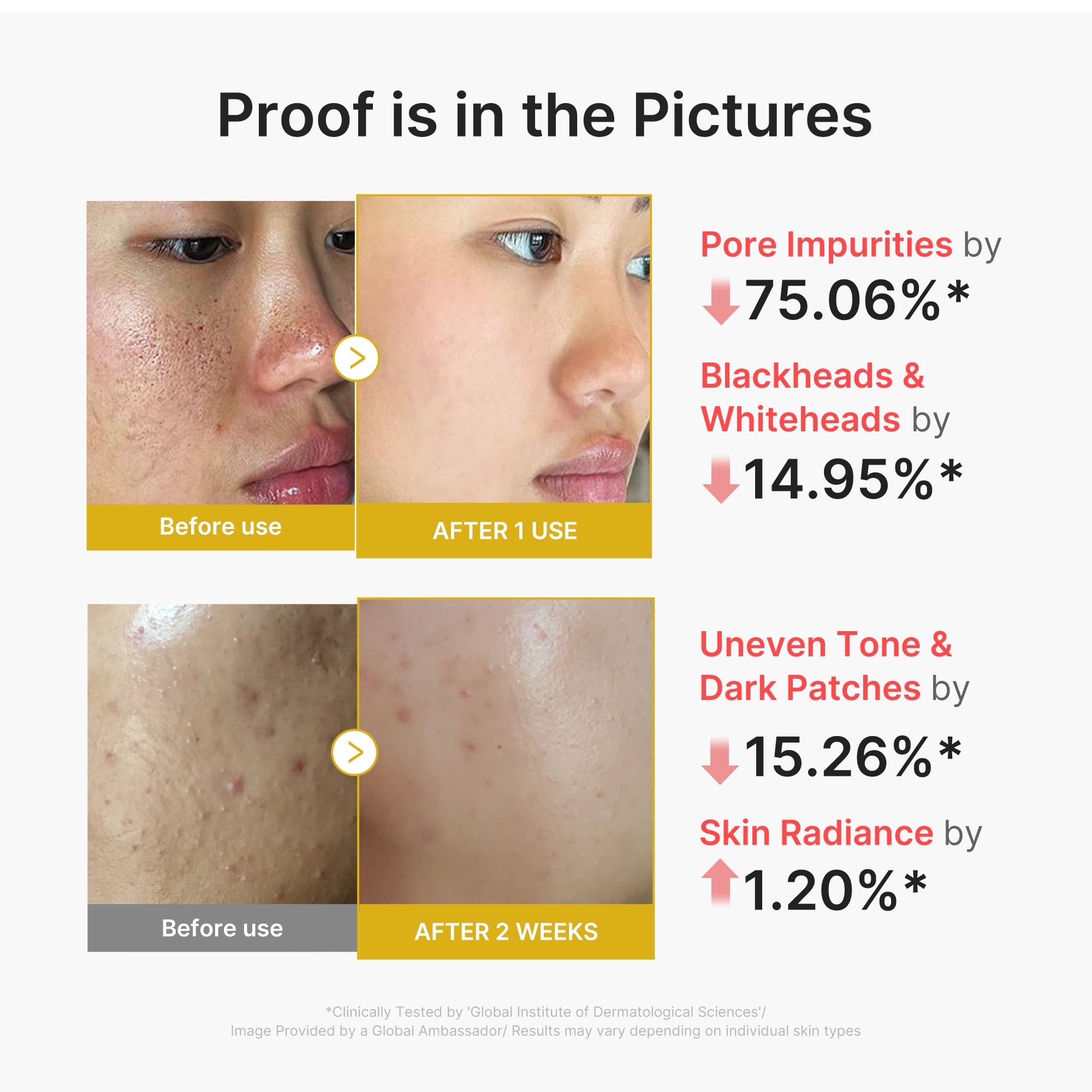 Kojic Acid Turmeric Peel Shot - For Thoughtful K Beauty