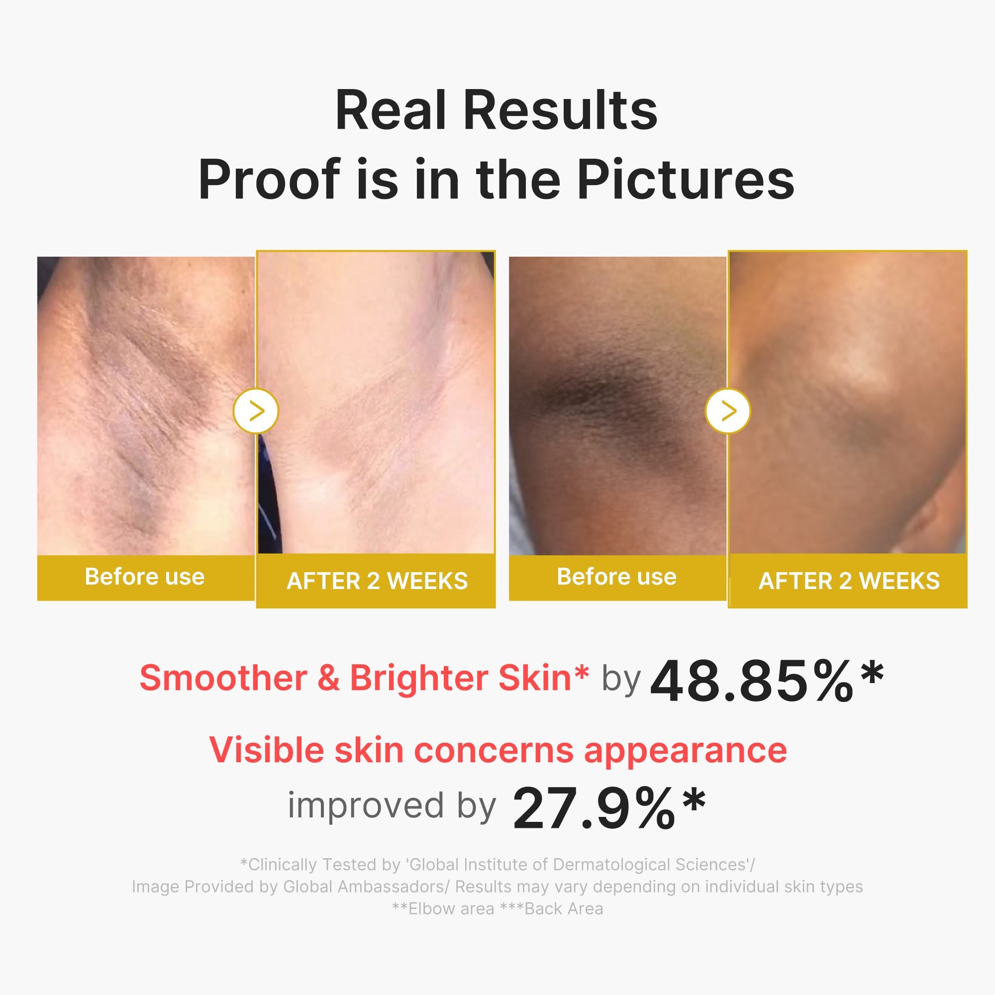 Kojic Acid Turmeric Body Peel Shot - Refined Medicube Routine