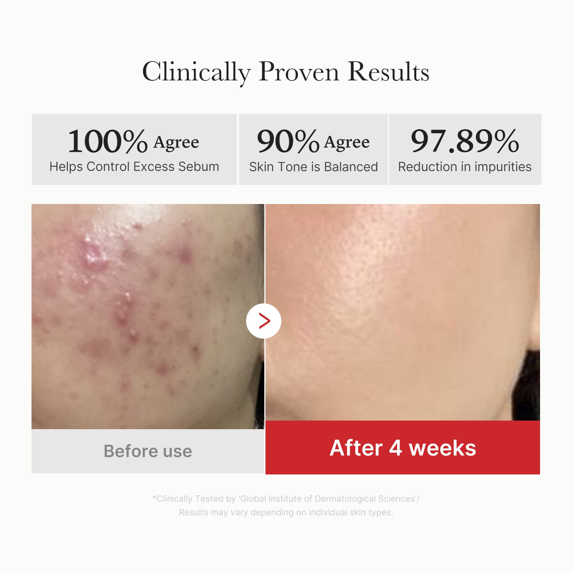 [GIFT] Red Succinic Acid Panthenol Pads - Made for Better Routines