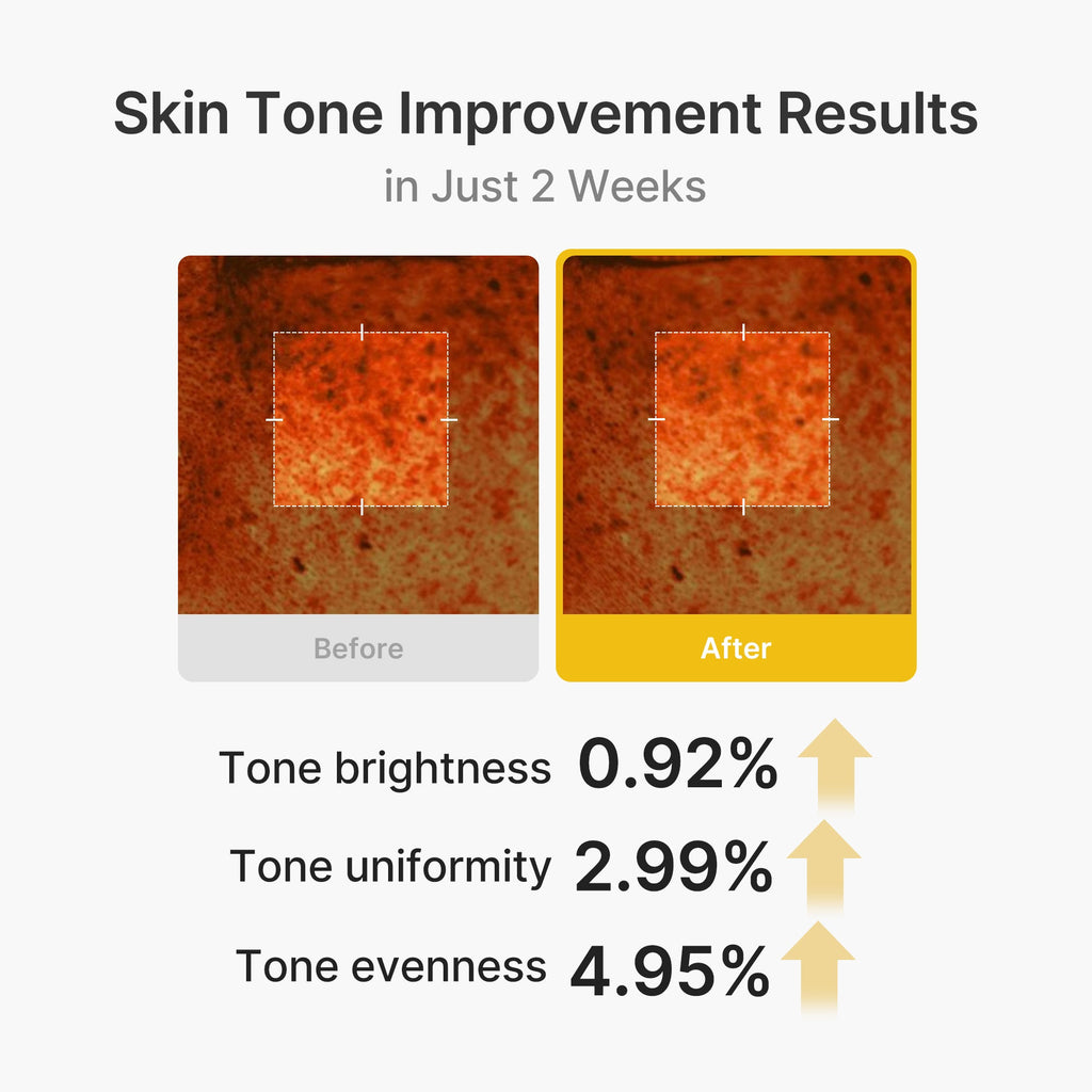 Kojic Acid Turmeric Vita Capsule Cream - Modern Feel Daily