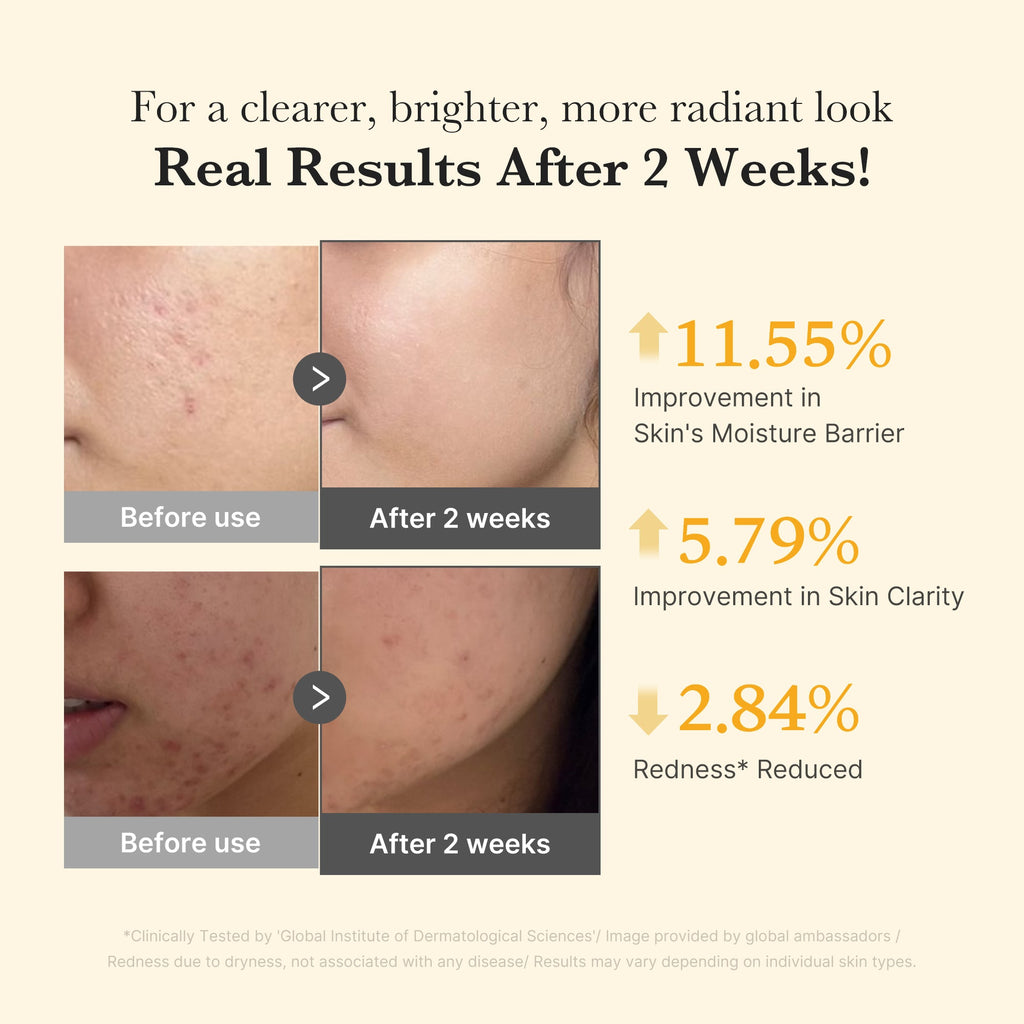 [GIFT] Kojic Acid Turmeric Capsule Serum - Beautiful Face Routine