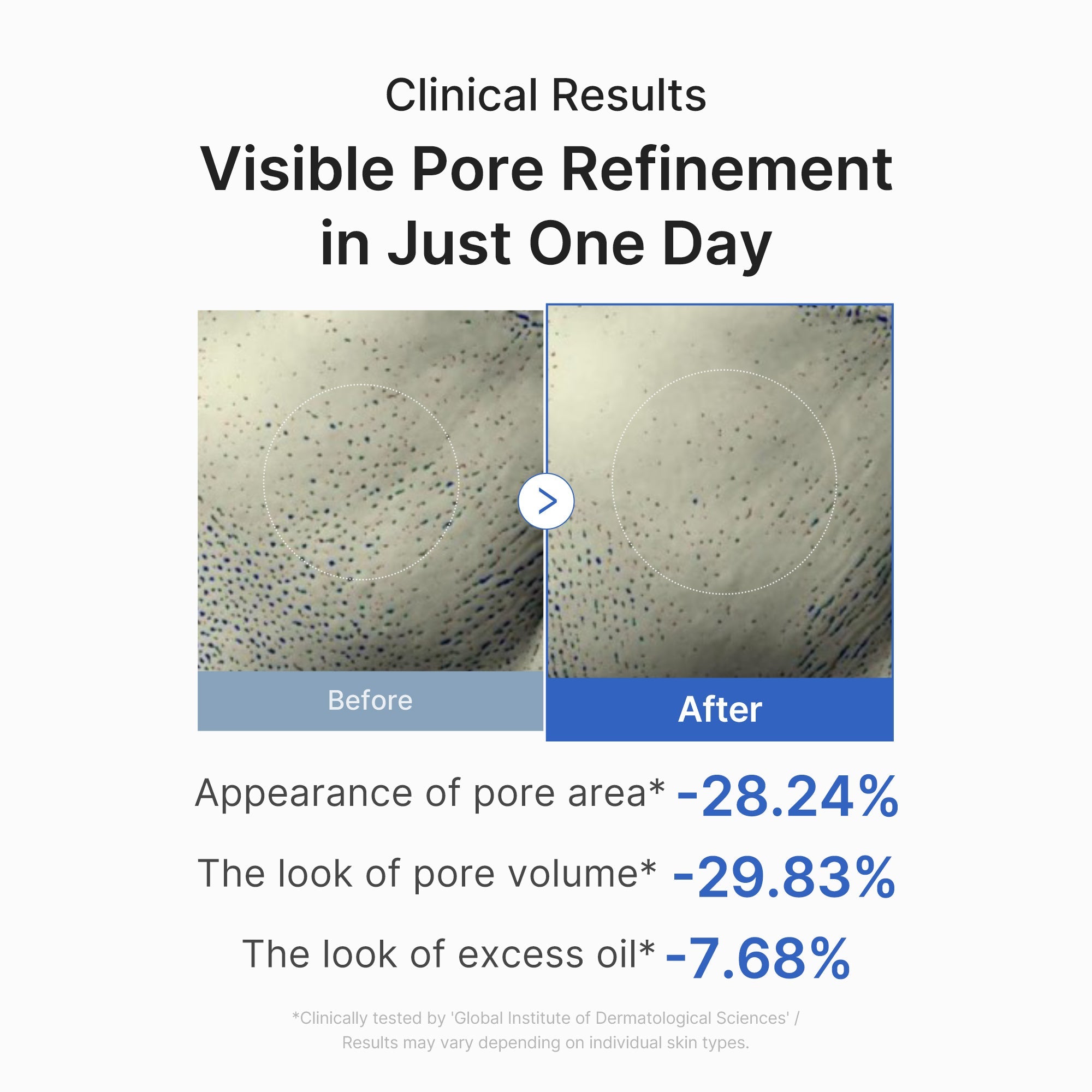 [GIFT] Zero Pore One-day Peptide Serum - Refresh Your Face Care