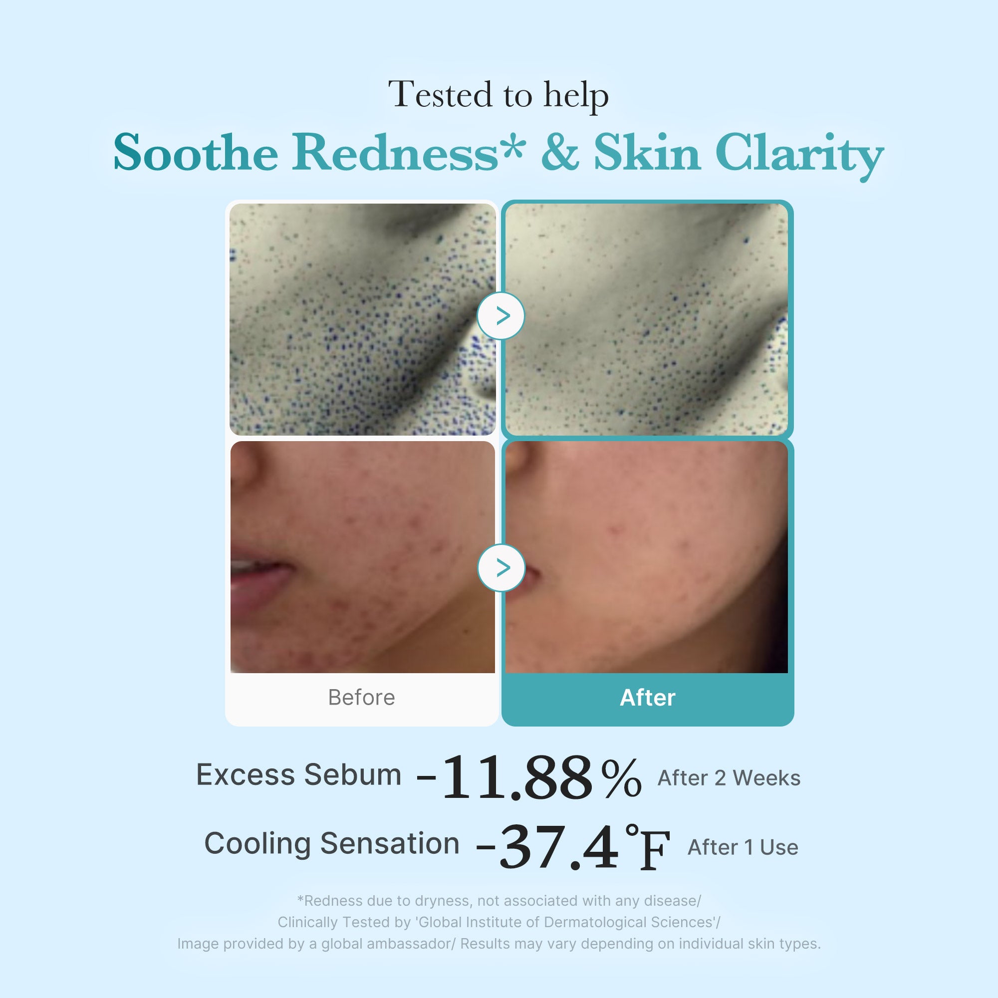 Azelaic Acid Niacinamide Clarifying Toner - Medicube Routine Pick