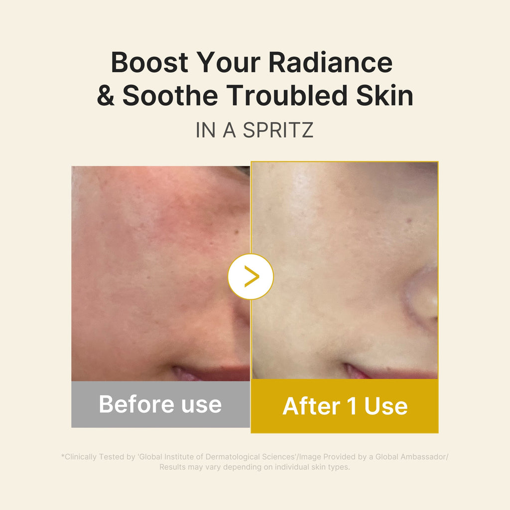 Kojic Acid Turmeric Vitamin Gold Jelly Mist Serum - Everyday Premium K Beauty