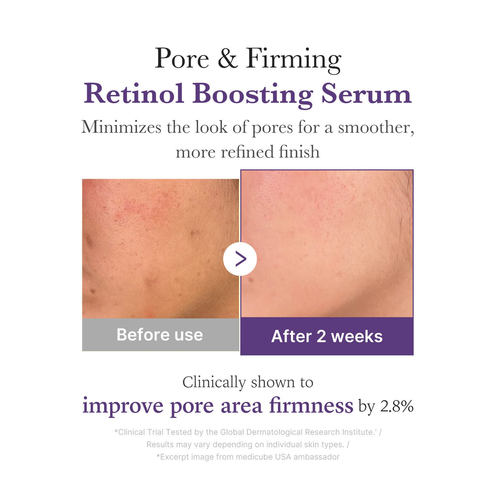 [GIFT] Retinol NMN Boosting Serum - A Modern Glow Routine