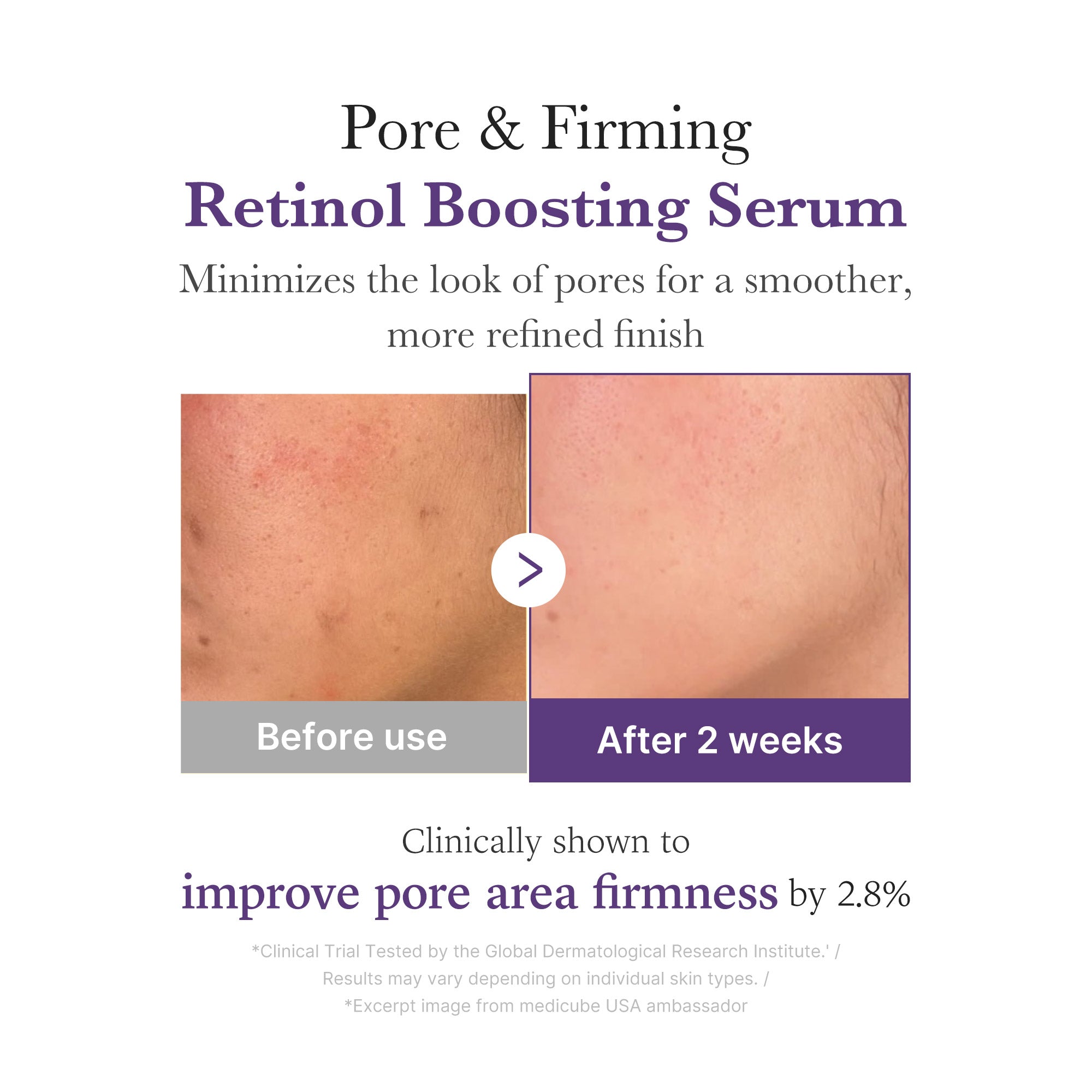[GIFT] Retinol NMN Boosting Serum - A Modern Glow Routine