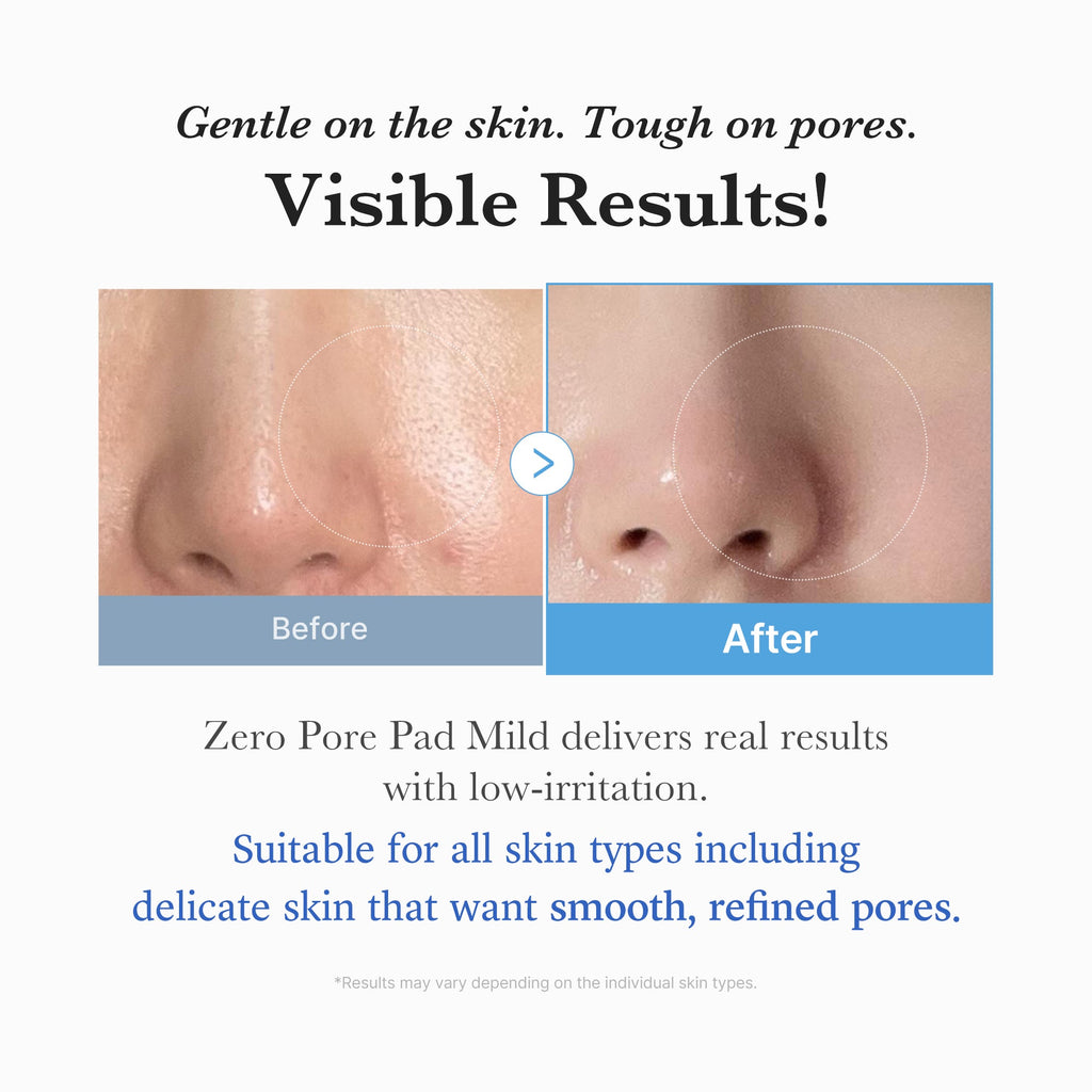 Zero Pore Madecassoside Pads (Mild) - Beautiful Fresh Skin