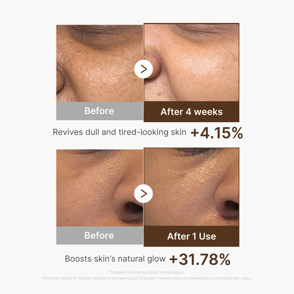 Deep Vitamin C Capsule Serum - The Refined Skin Edit