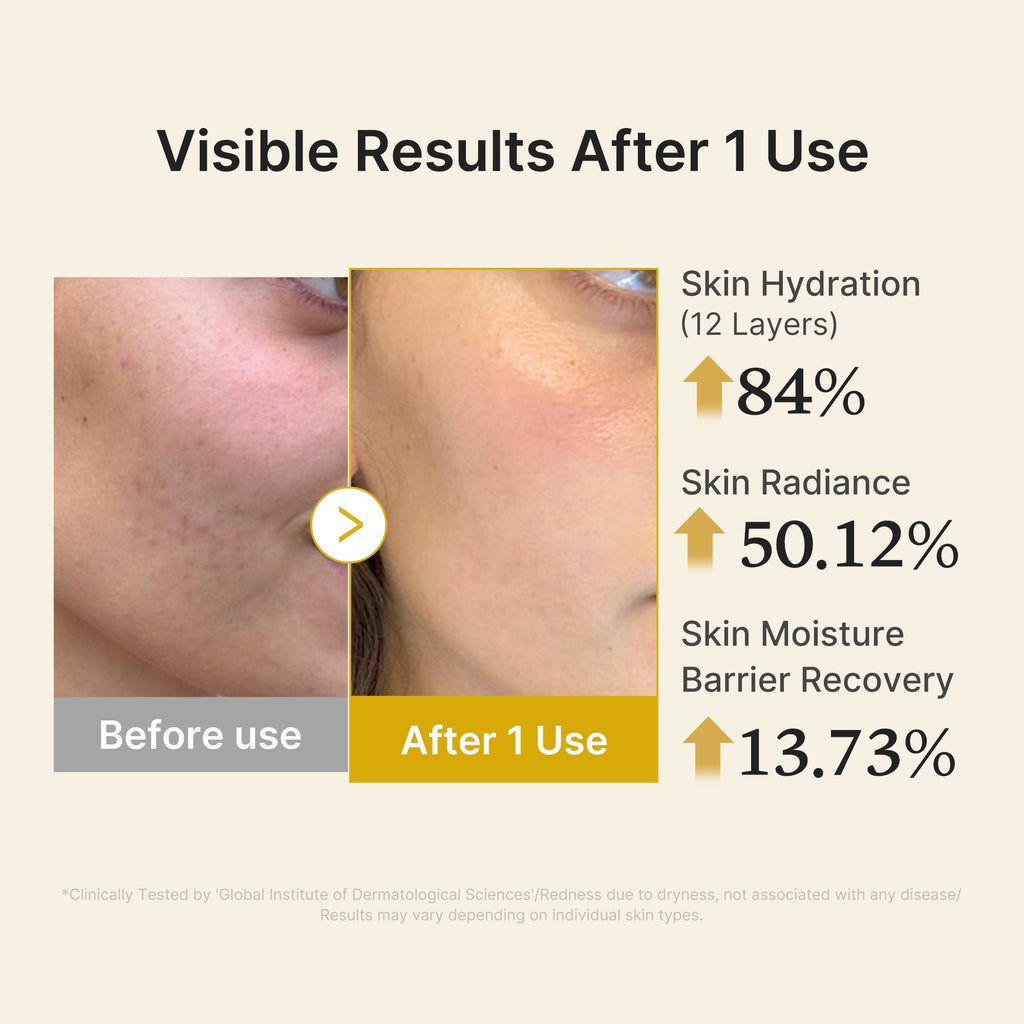 Kojic Acid Turmeric Vitamin Gold Jelly Mist Serum - Everyday Premium K Beauty