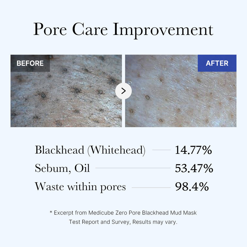 [Subscr.] Zero Pore Blackhead Mud Mask - Refined Care in Hand