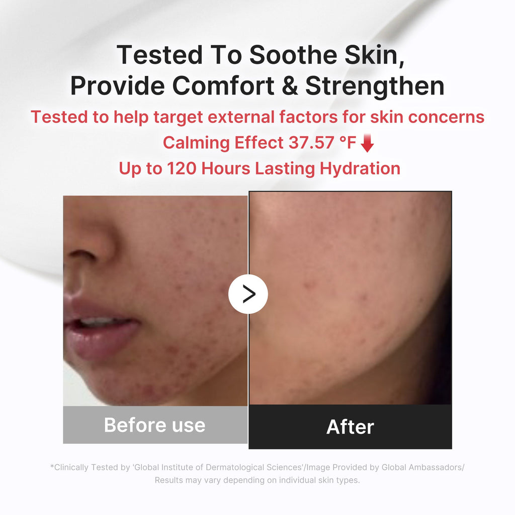 3H Daily Relief Cream - Care Fresh