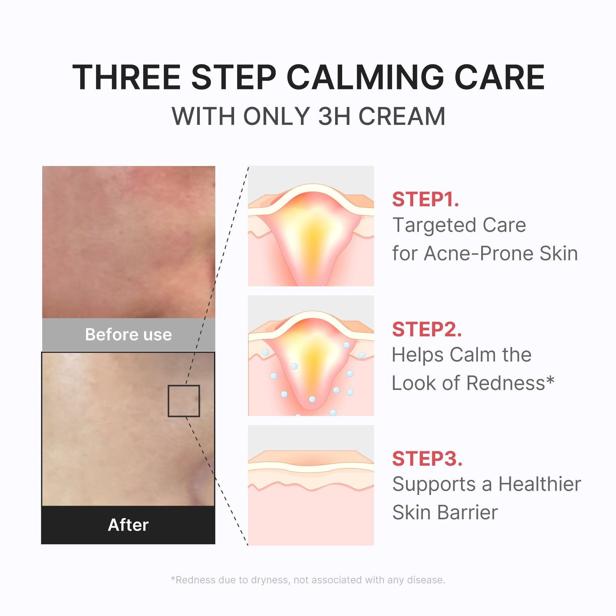 3H Daily Relief Cream - Care Fresh