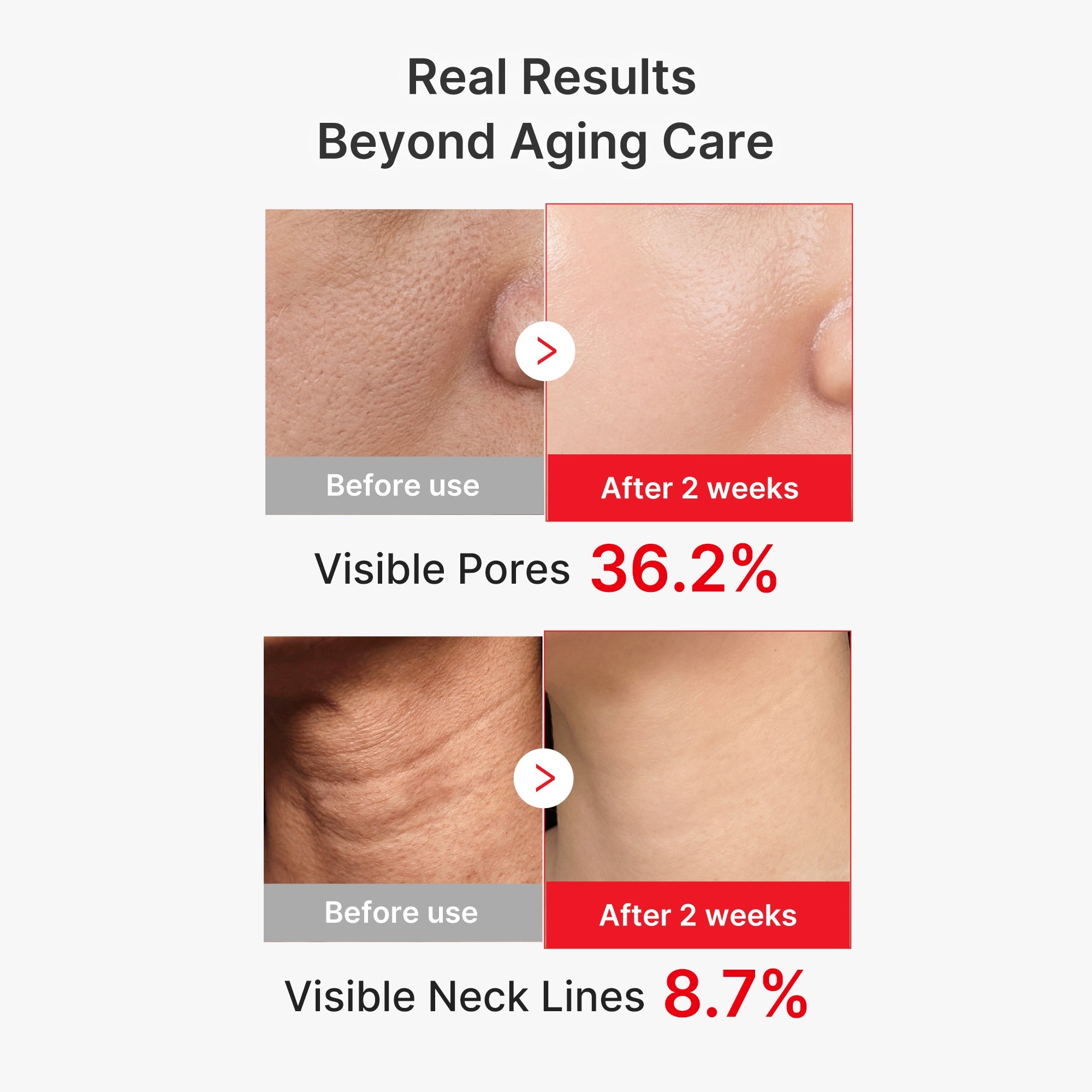 EGF NAD+ Firming Serum - Care. Glow. Elevate.