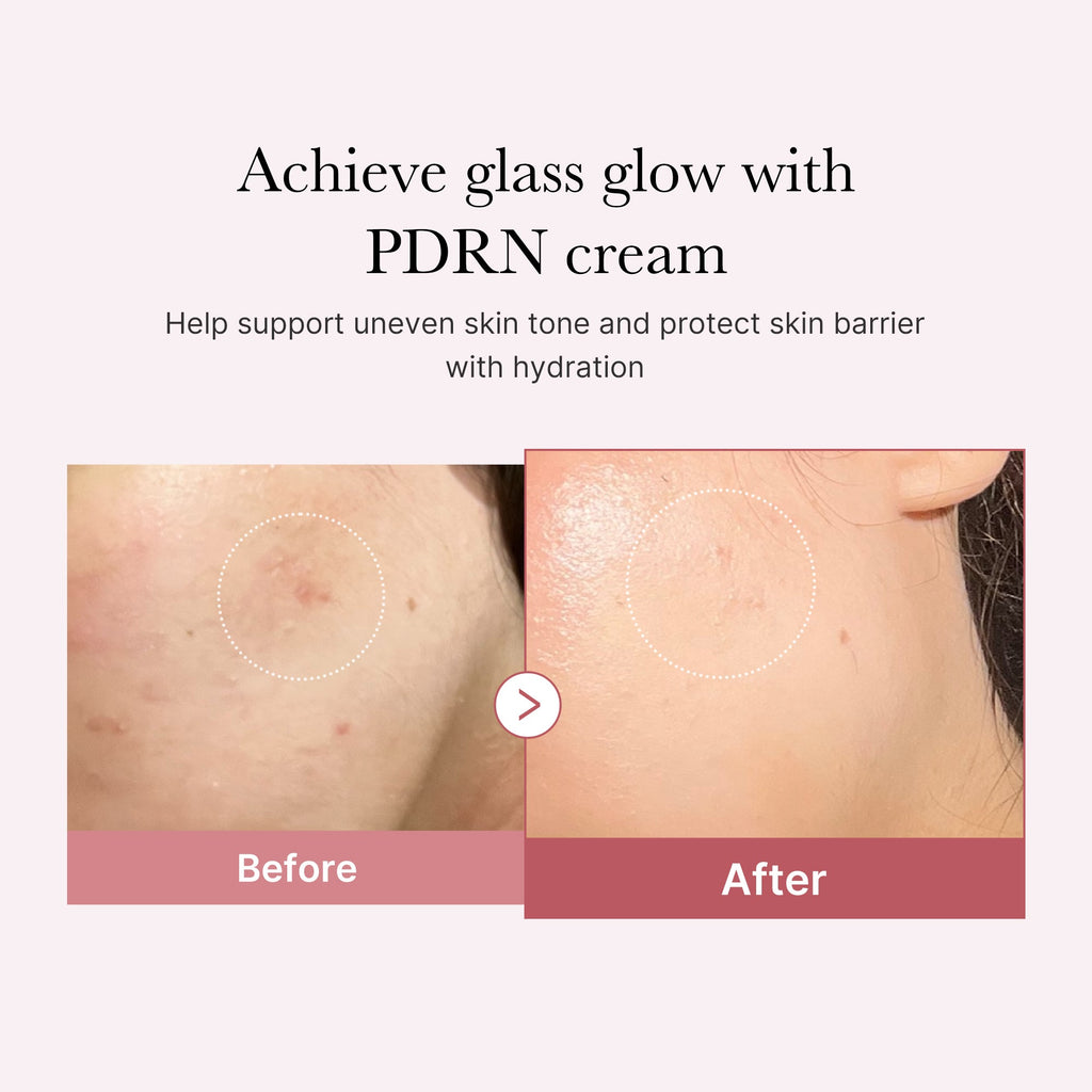 [Subscr.] PDRN Pink Peptide Cream - Glow with Style