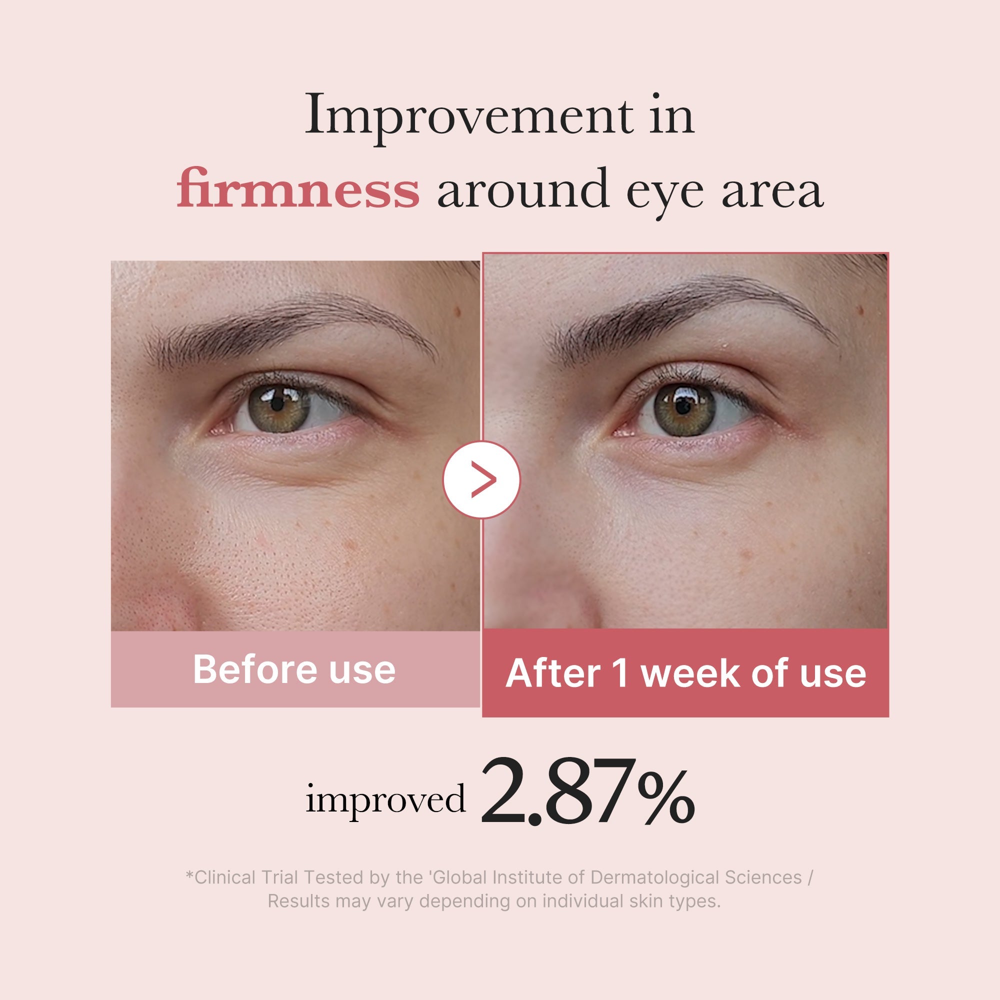 PDRN Pink Peptide Eye Cream - Skin Care for Refined Routines