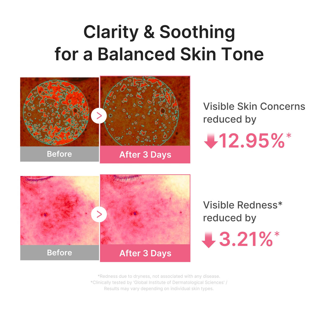 Ultra Light PDRN Pink Peptide Serum - Subtle Glow Style