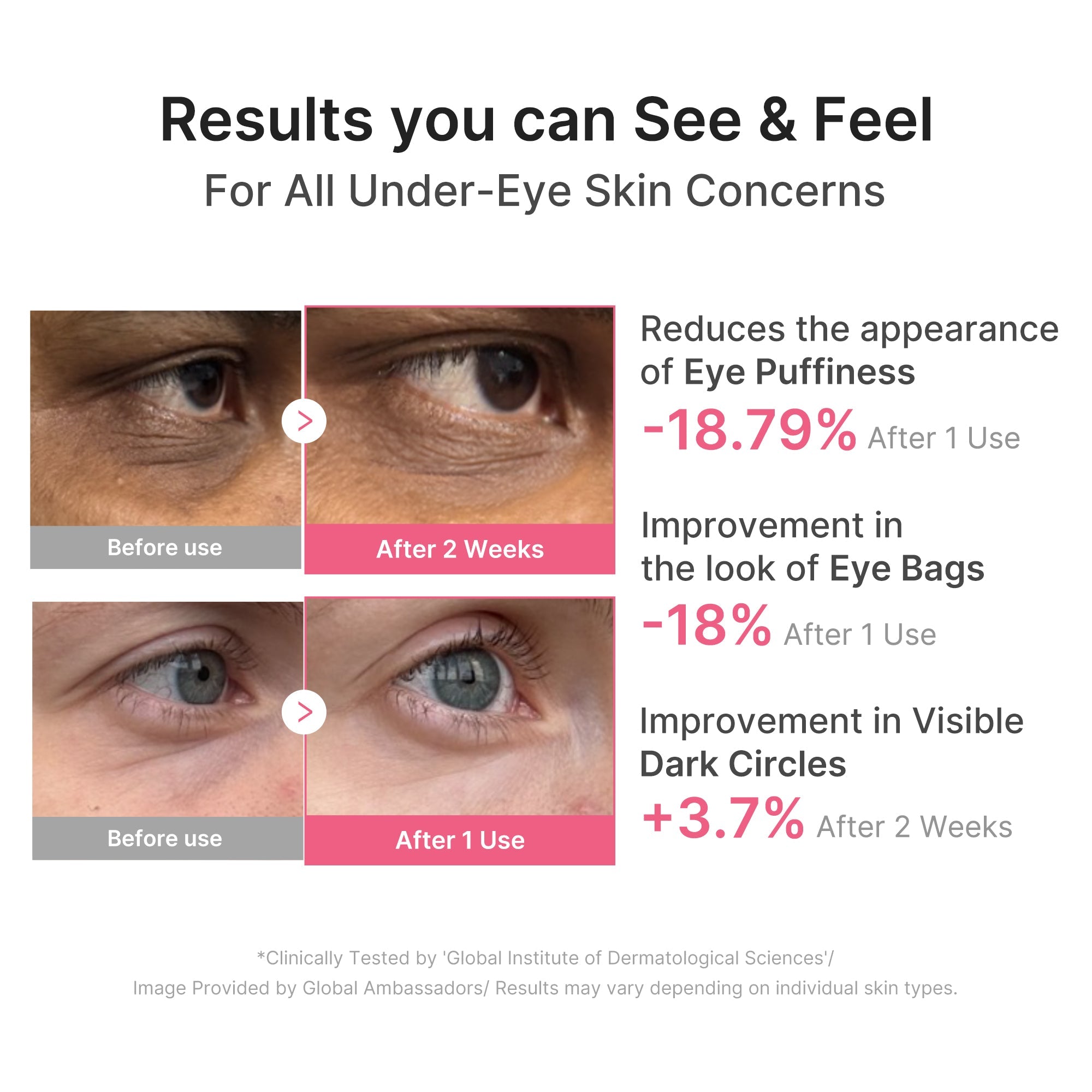 PDRN Caffeine Collagen Eye Patch - Fresh Skin with Style