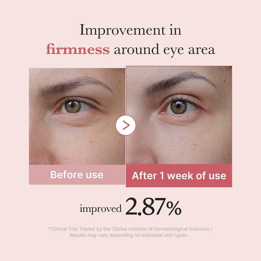 [Subscr.] PDRN Pink Peptide Eye Cream - For Better Daily Glow