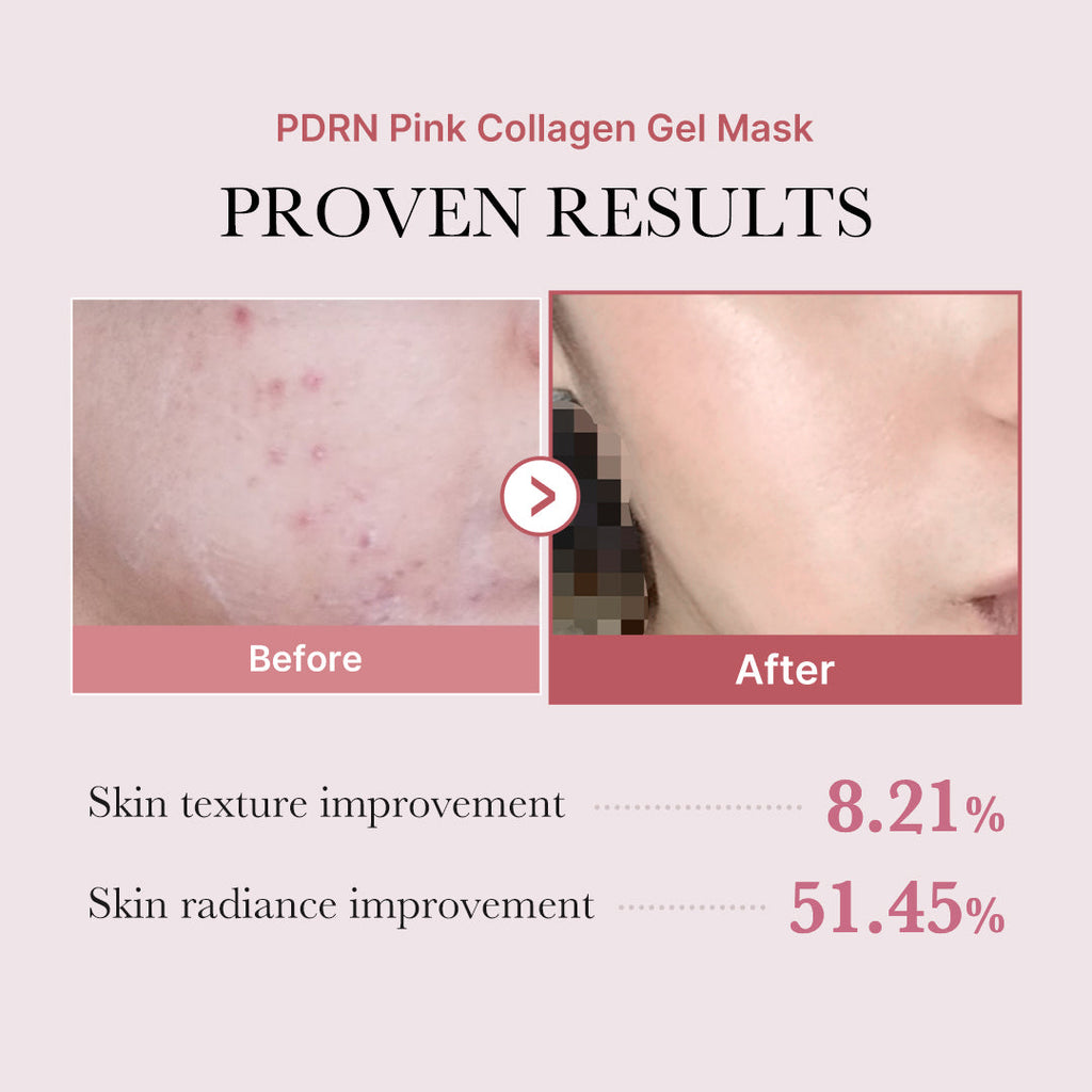 PDRN Pink Glow Full Set - Medicube That Fits