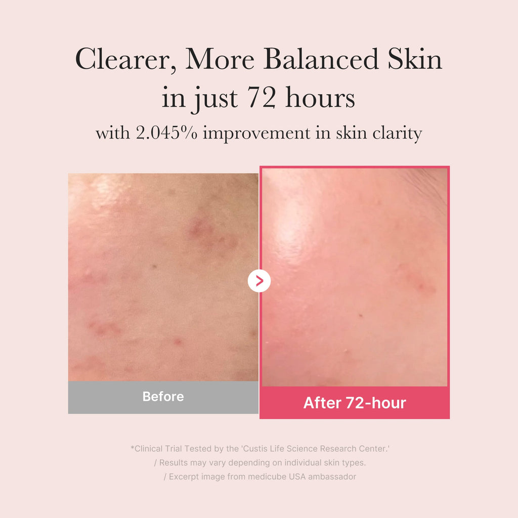[GIFT] TXA Niacinamide Serum - The Modern Skin Edit