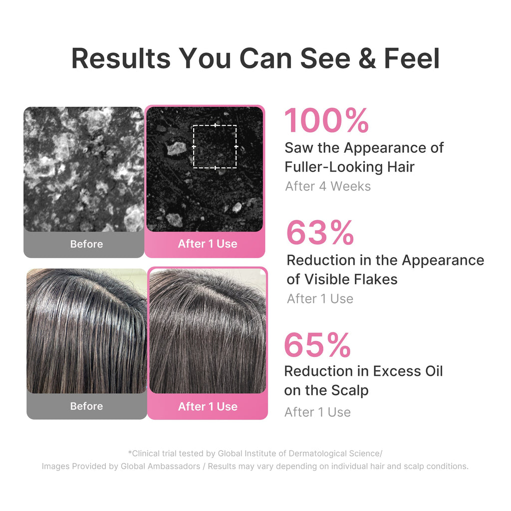 Rosemary PDRN Cooling Thickening Shampoo - A Smarter Beauty Routine