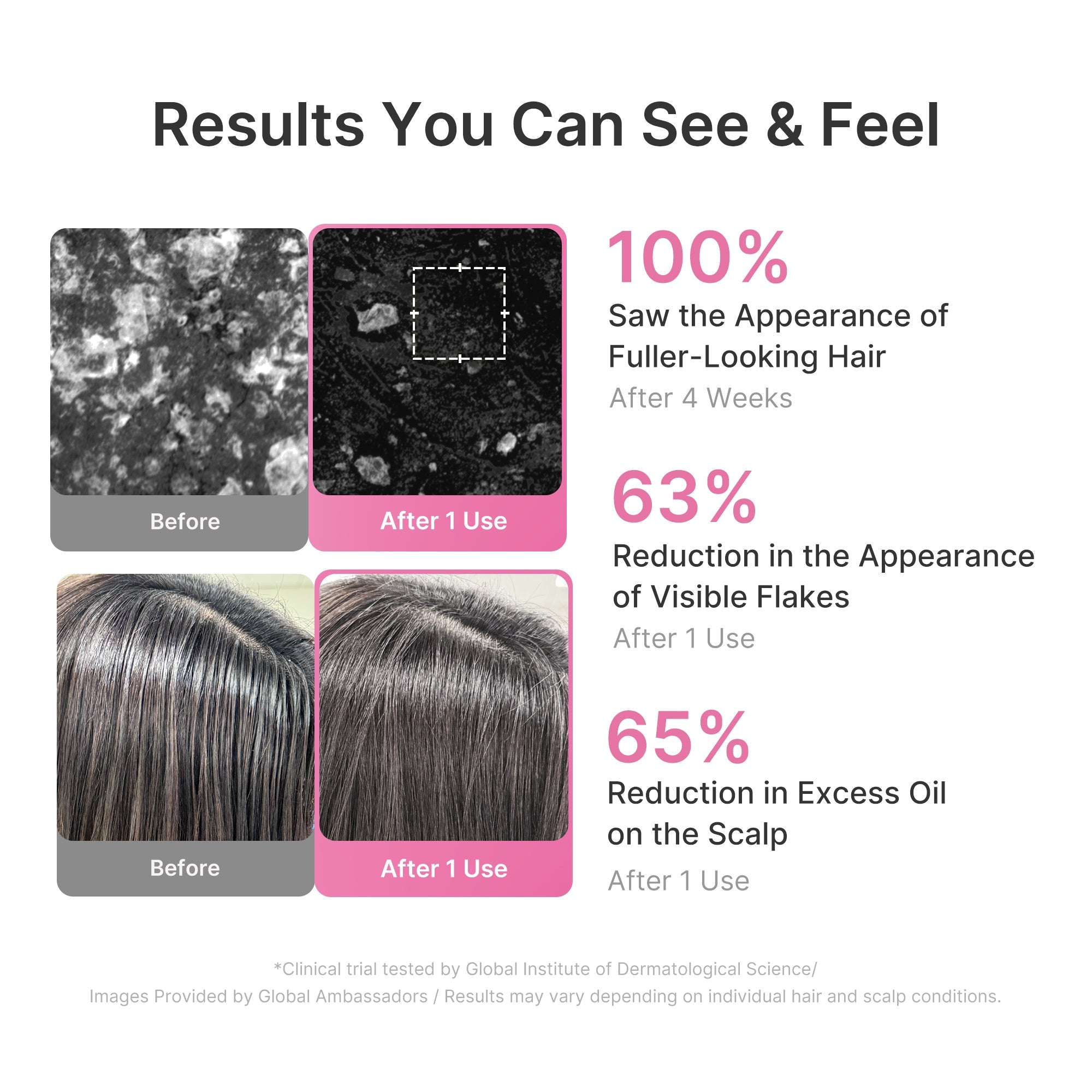 Rosemary PDRN Cooling Thickening Shampoo - A Smarter Beauty Routine