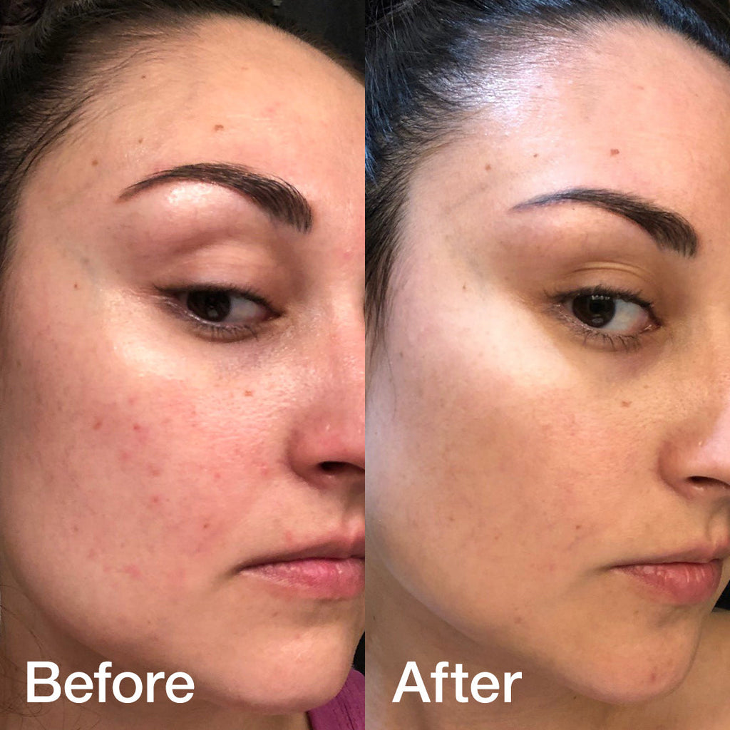 [GIFT] Glass Glow Duo - Elevated Face Essential