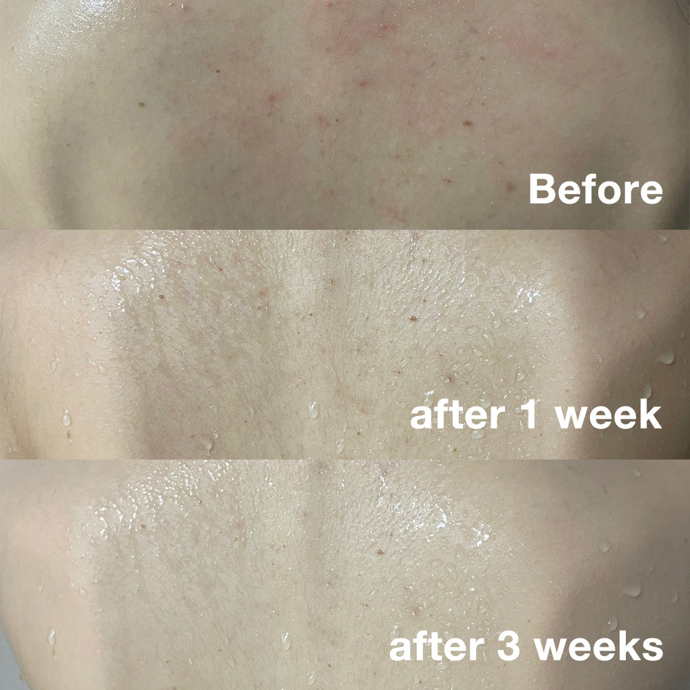 [GIFT] Red Body Wash - Beauty Routine Reimagined