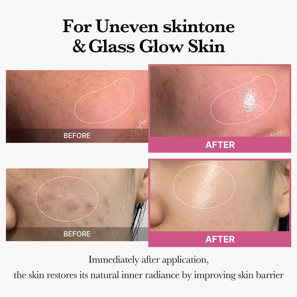 [Tati's Exclusive] Plump Perfection Set - The Medicube Skin Routine